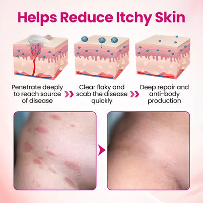 Victory® IntiDefend Anti-HPV Interferon Gel