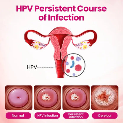 Victory® IntiDefend Anti-HPV Interferon Gel